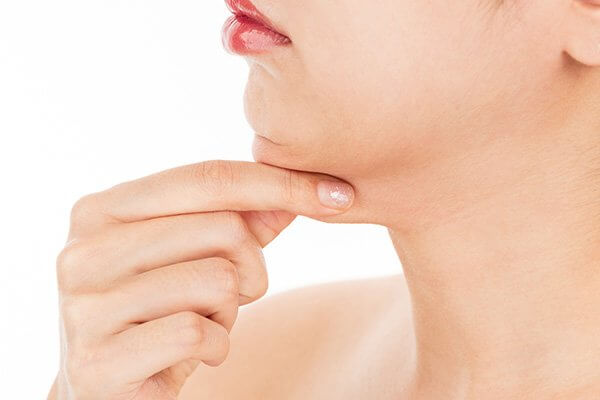 Submental Liposuction
